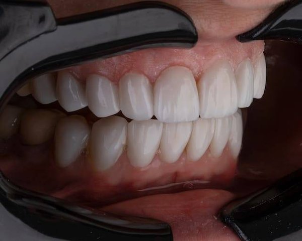 Comment prendre soin de ses dents au quotidien ?
